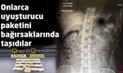 Onlarca uyuşturucu paketini bağırsaklarında taşıdılar