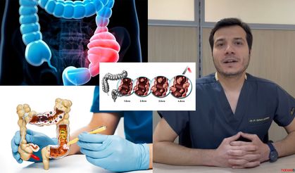 Kolon kanseri tarama testleri hayat kurtarır