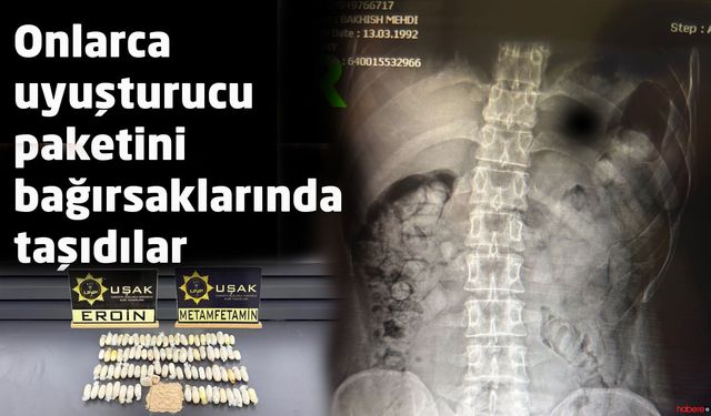 Onlarca uyuşturucu paketini bağırsaklarında taşıdılar